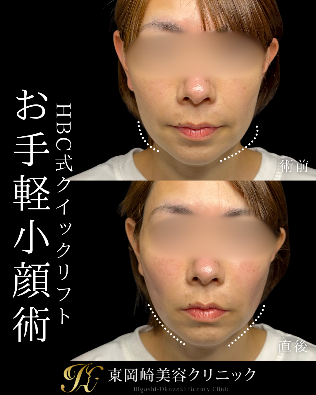 症例イメージ