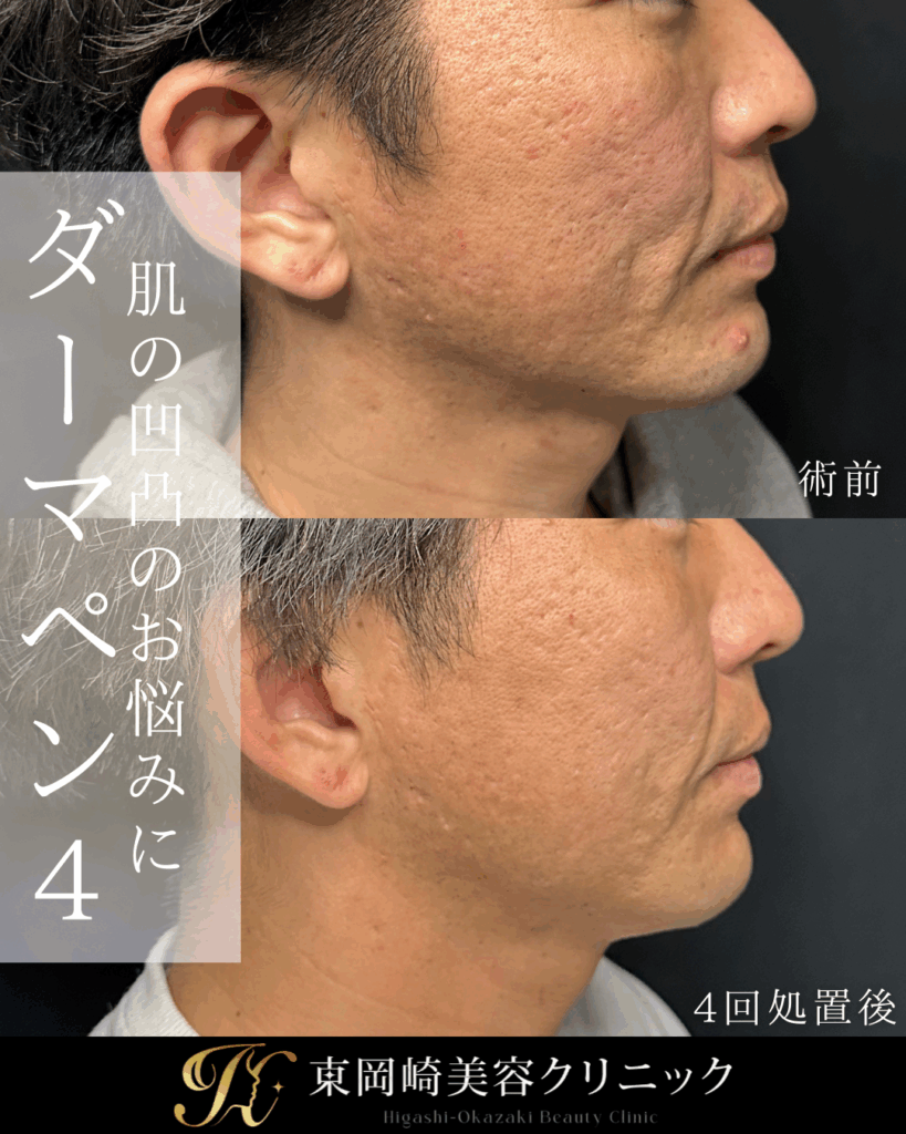 症例イメージ