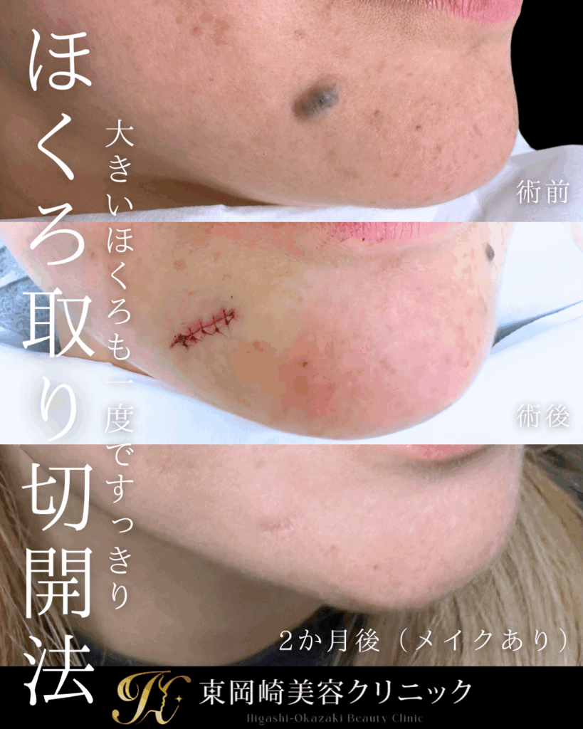 症例イメージ
