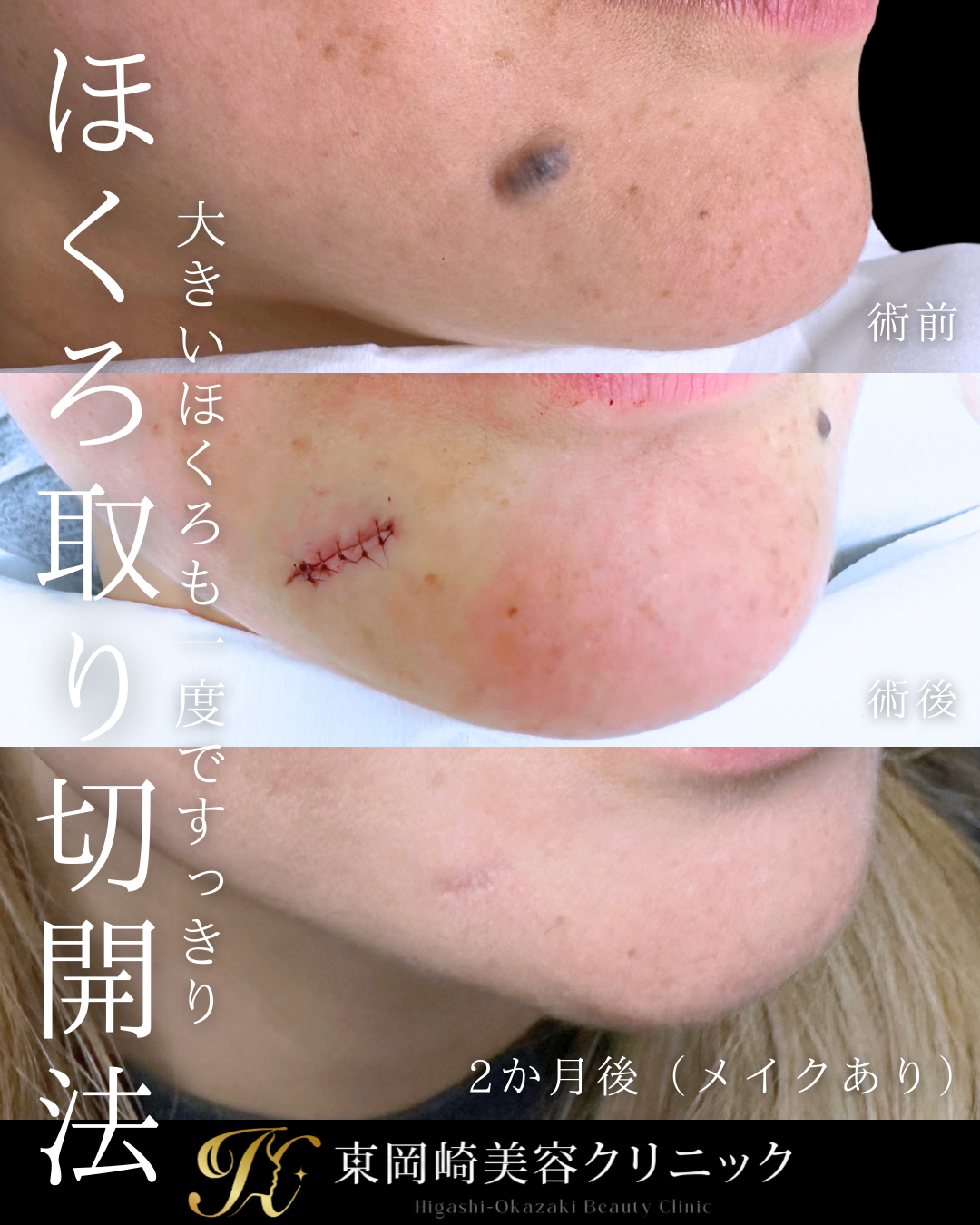 症例イメージ