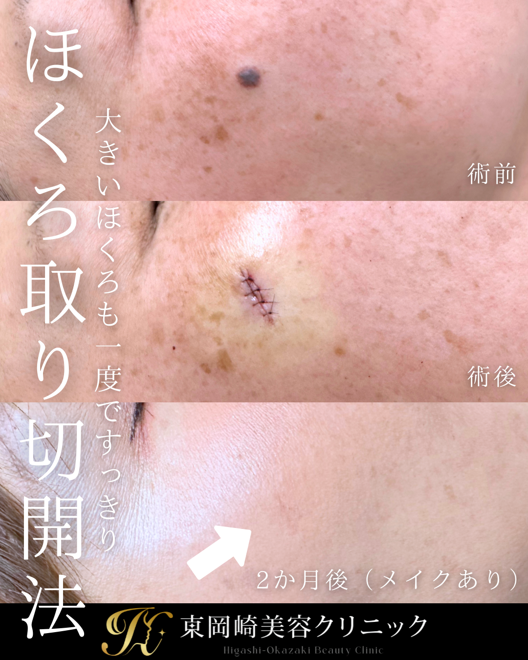 症例イメージ