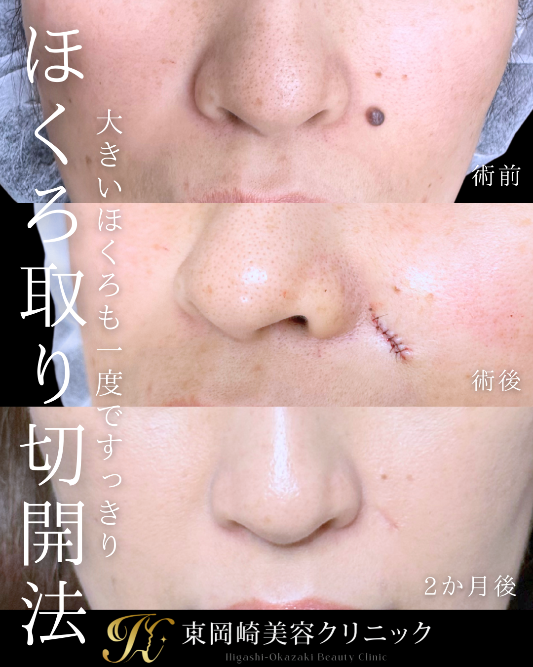 症例イメージ