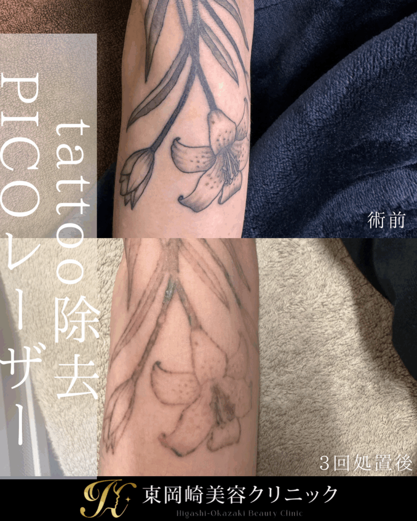 症例イメージ