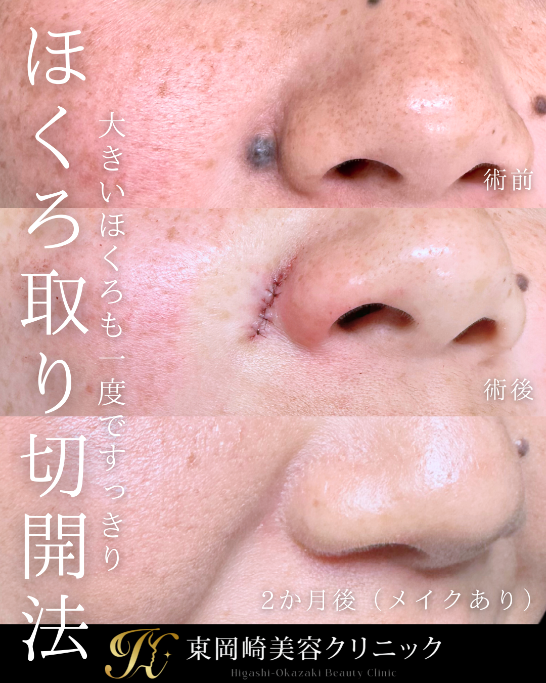 症例イメージ