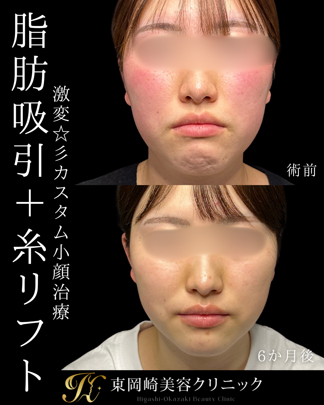 症例イメージ