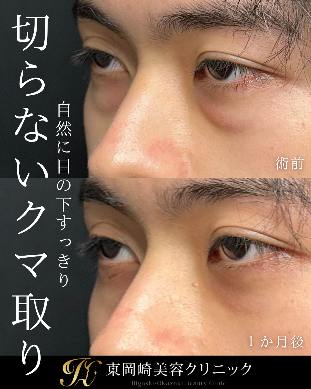 症例イメージ