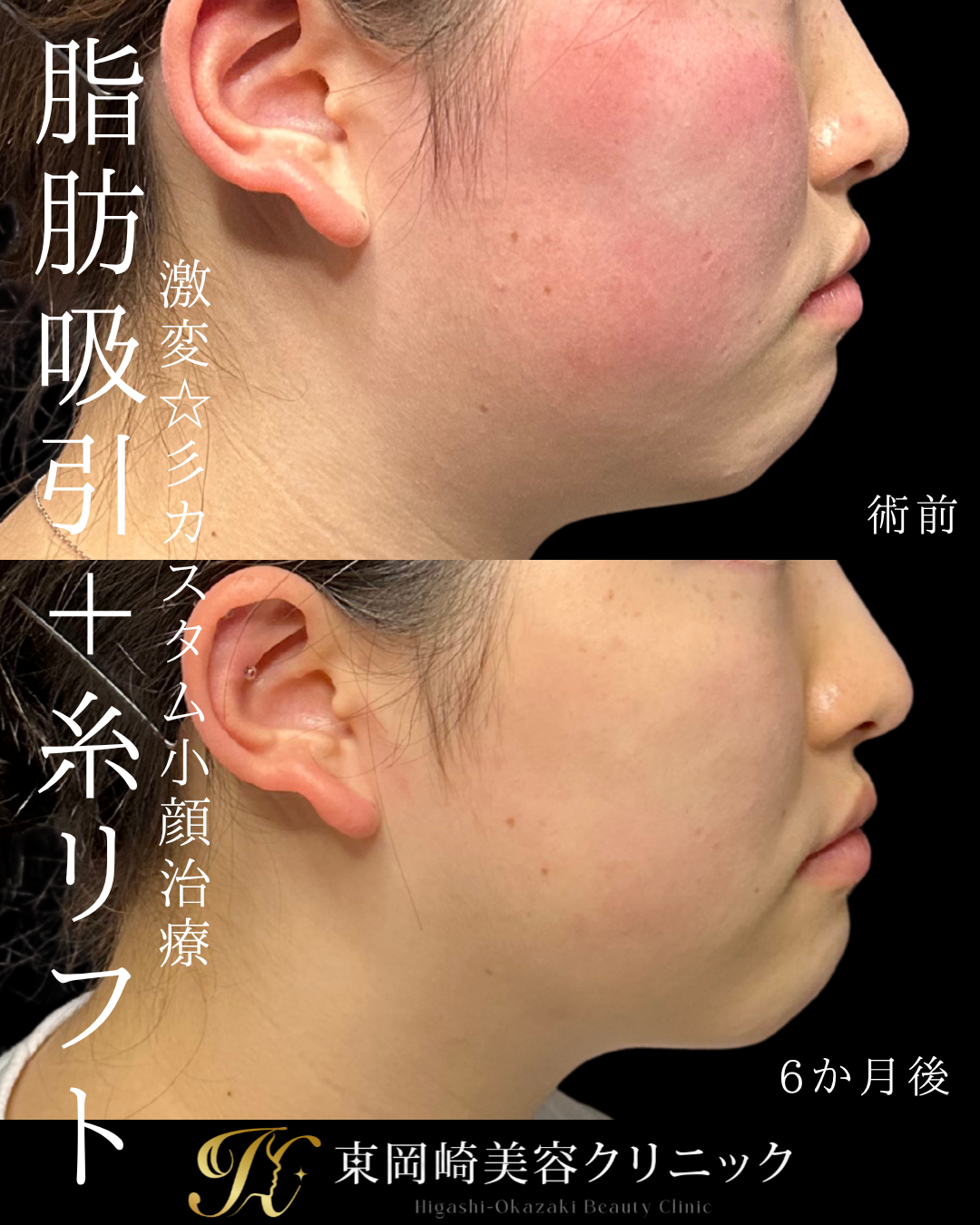 症例イメージ