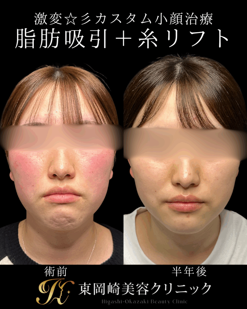 症例イメージ