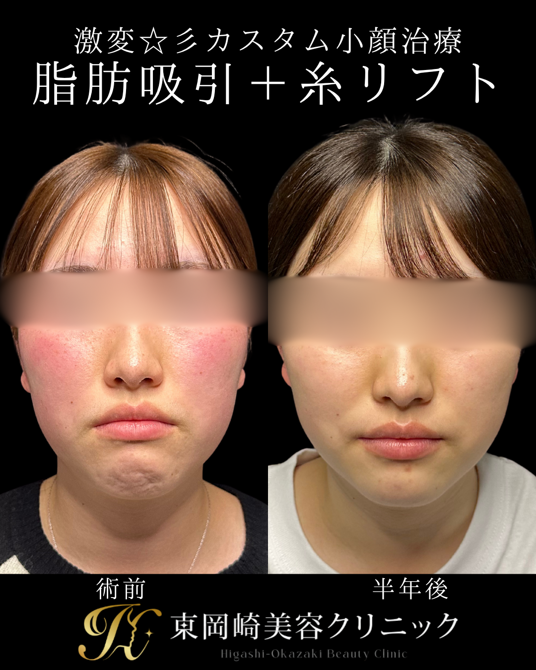 症例イメージ