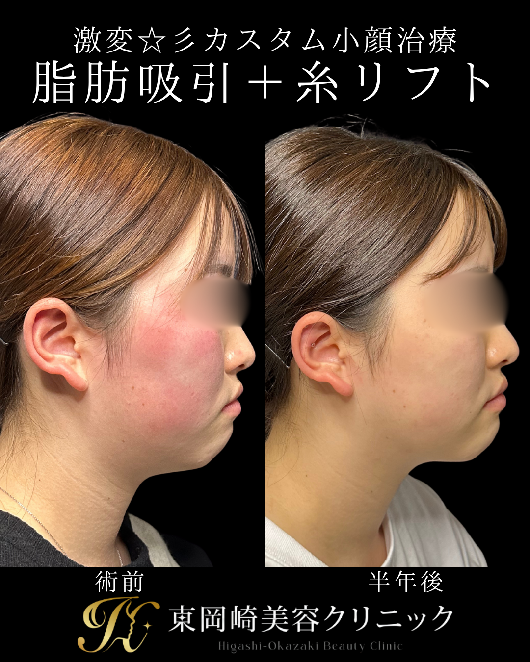 症例イメージ