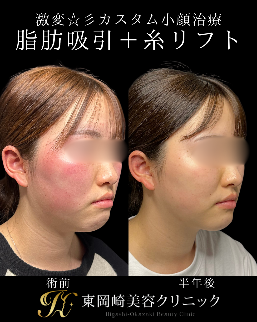 症例イメージ