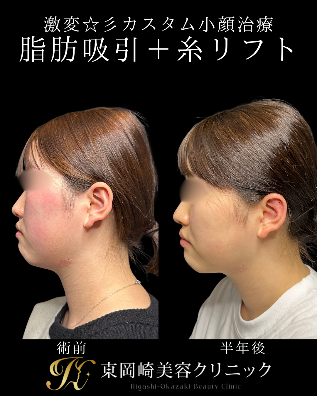 症例イメージ