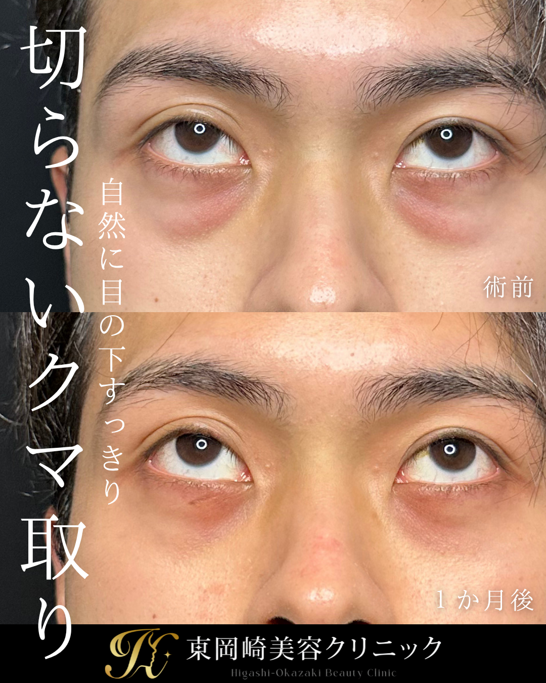 症例イメージ