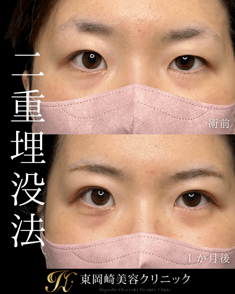 症例イメージ