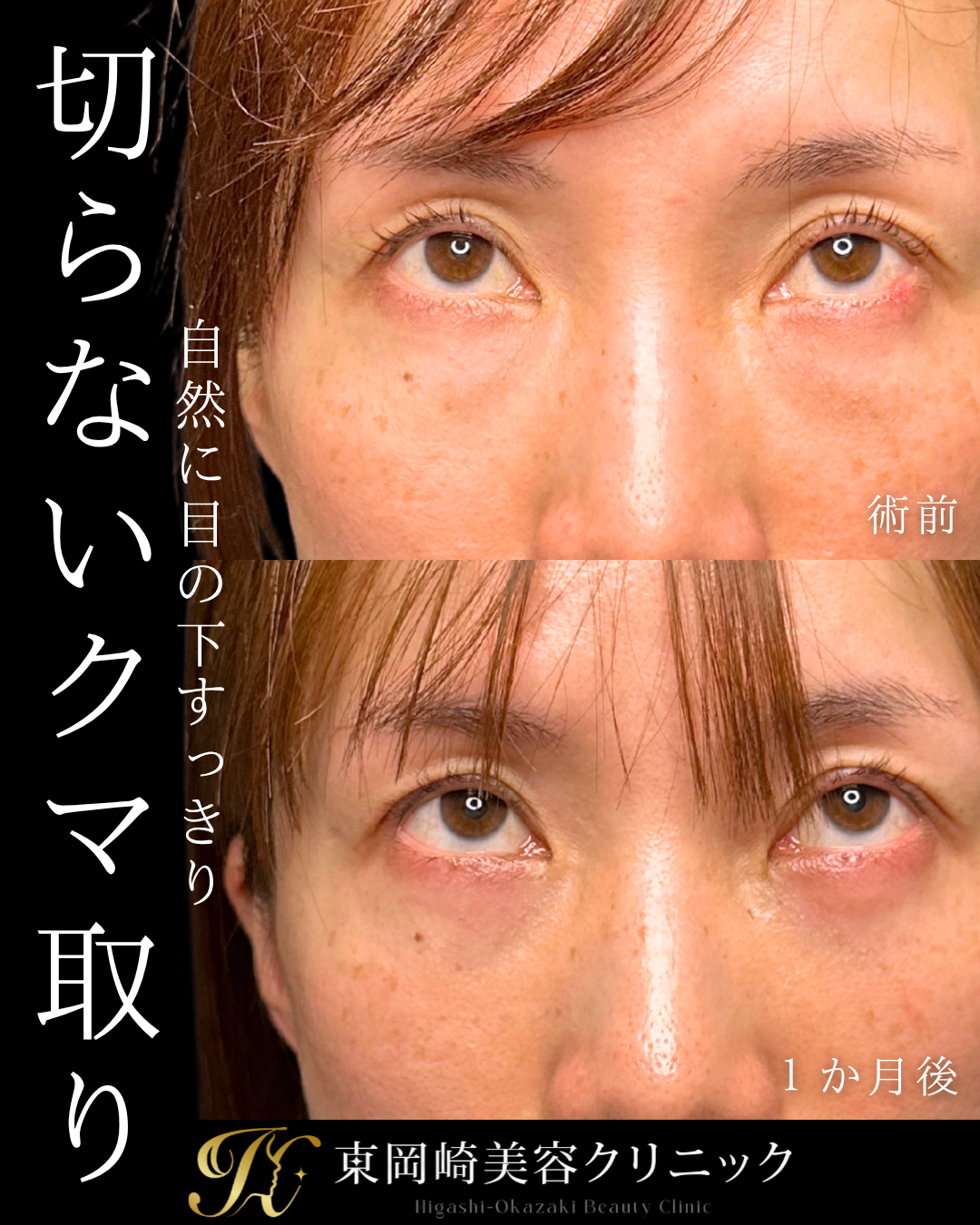 症例イメージ