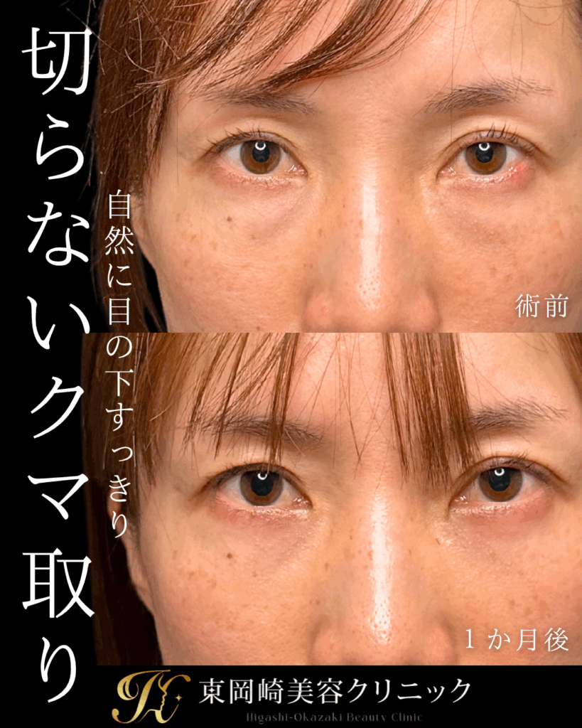 症例イメージ