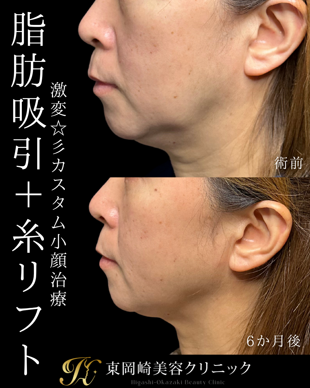 症例イメージ