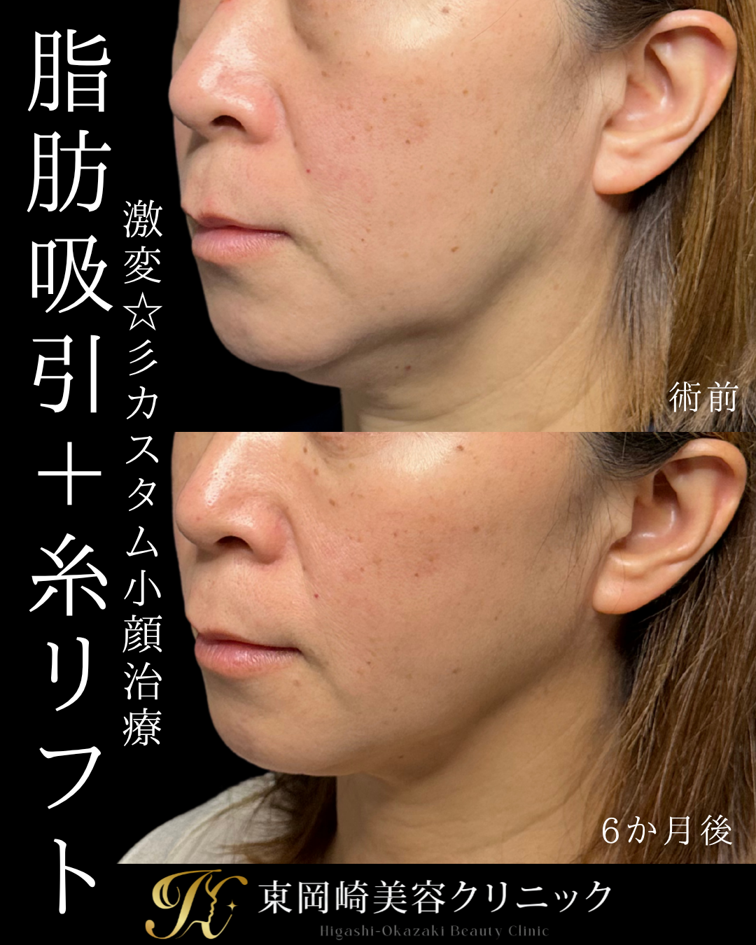 症例イメージ