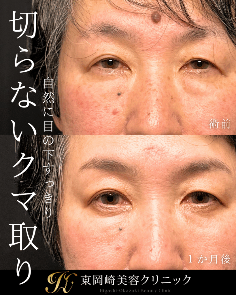 症例イメージ
