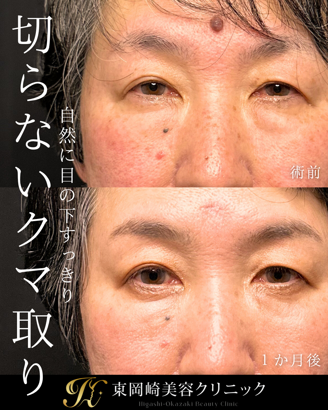 症例イメージ