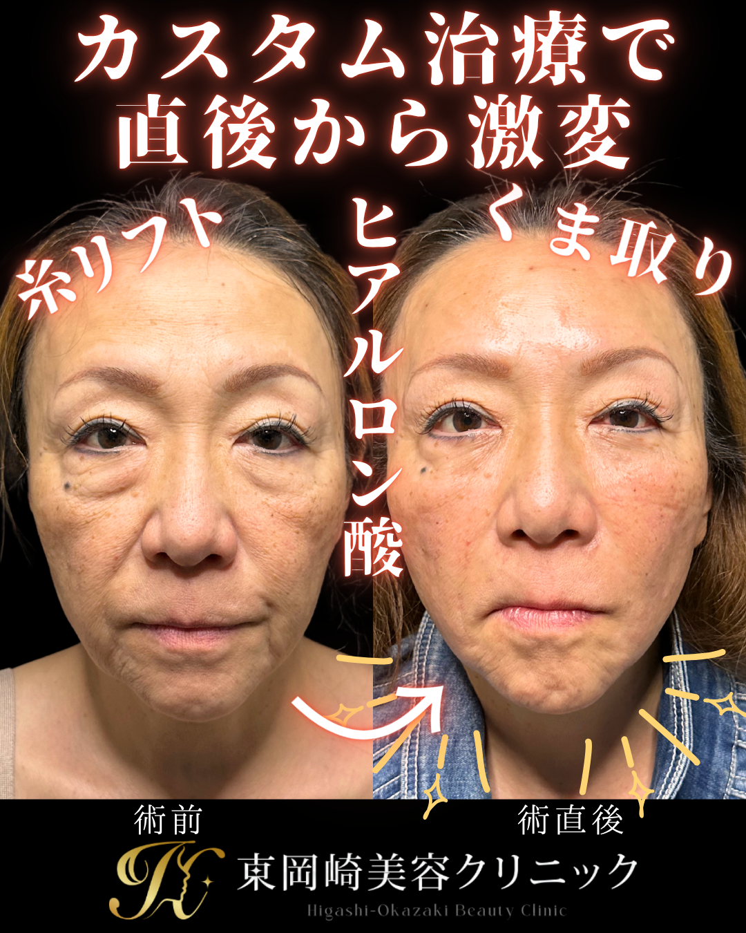 症例イメージ