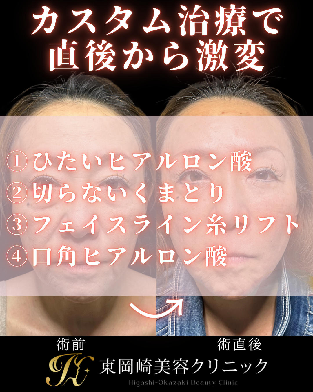 症例イメージ