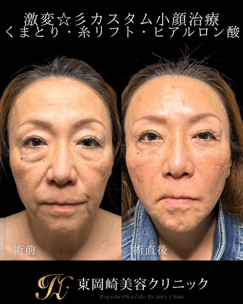 症例イメージ