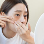 青クマを改善したいあなたへ｜原因と治療法をわかりやすく解説