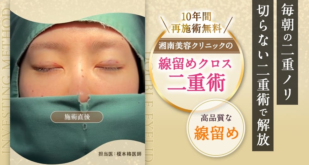 湘南美容クリニック二重整形FV