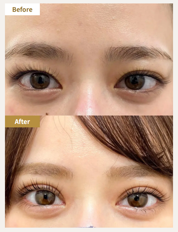 HAABクリニック 東京本院-症例