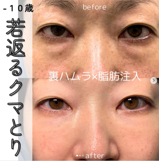 eクリニック-坂本-優衣-医師-症例写真