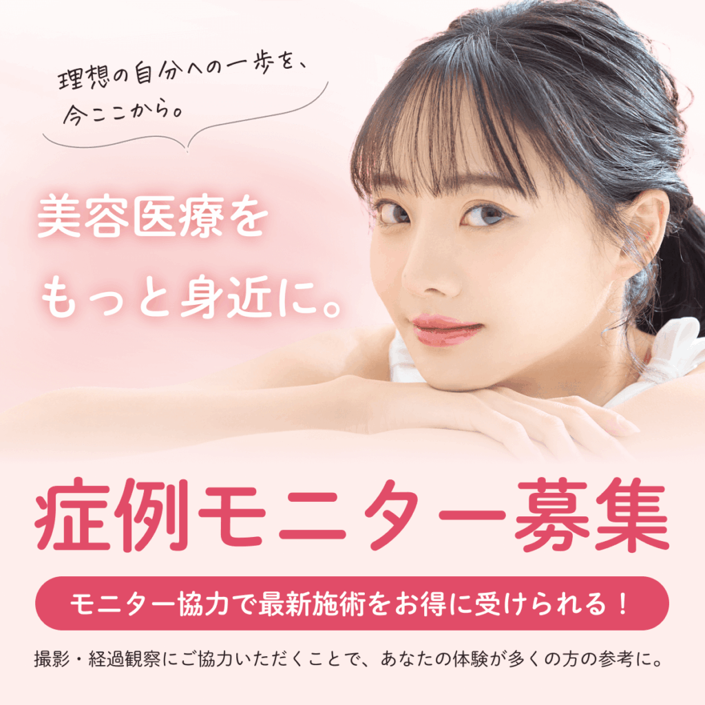 症例モニター募集