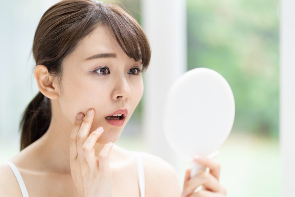 肌荒れを気にする女性