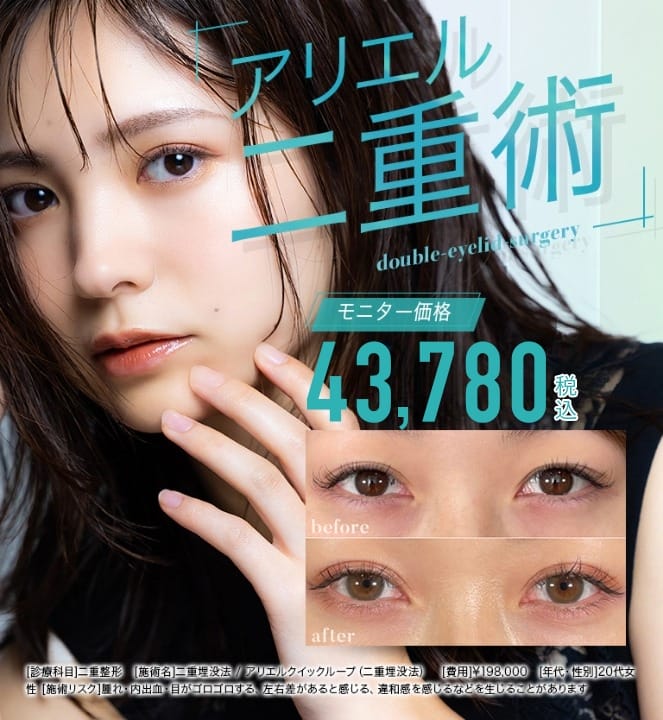アリエル美容クリニック二重整形FV.