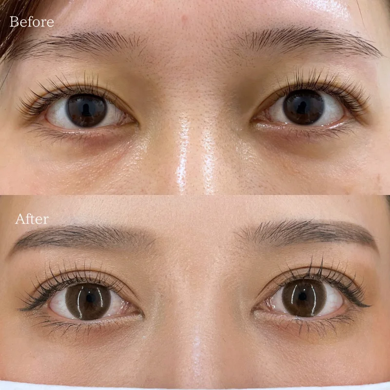 HAABクリニック-田中 優太医師-症例