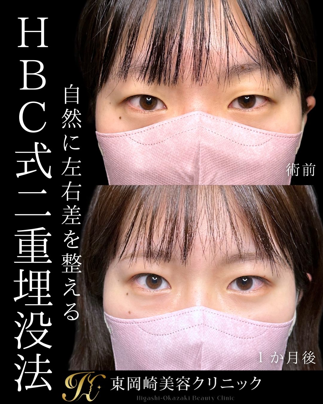 HBC式1dayプレミアムアイ