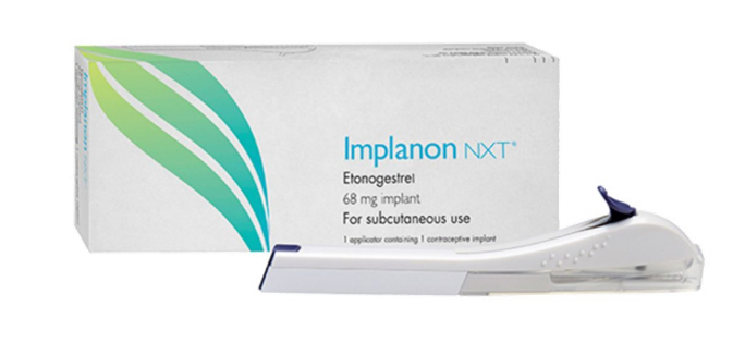 避妊インプラント