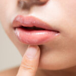 唇の色素沈着を改善する方法｜原因・ケア・美容皮膚科での治療まで解説
