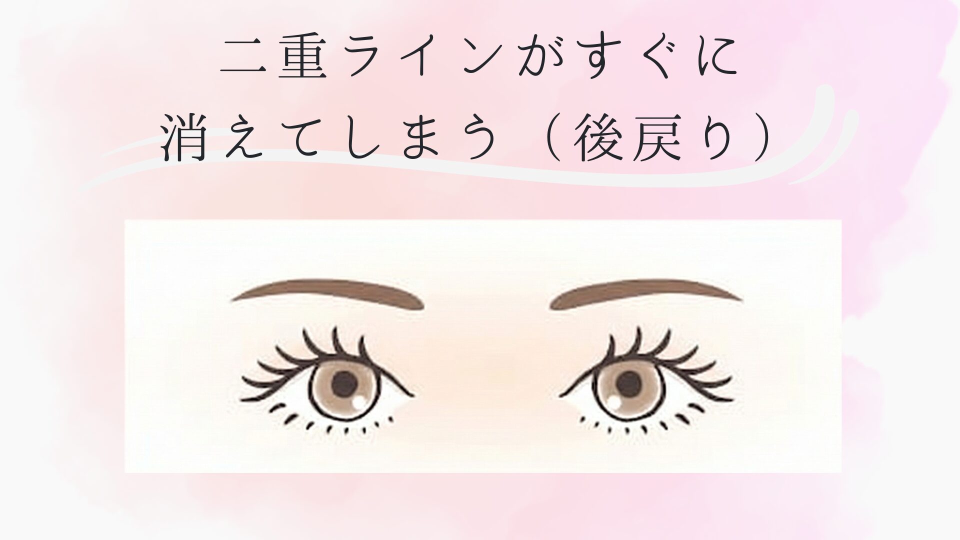 二重ラインがすぐに消えてしまう（後戻り）イメージ図