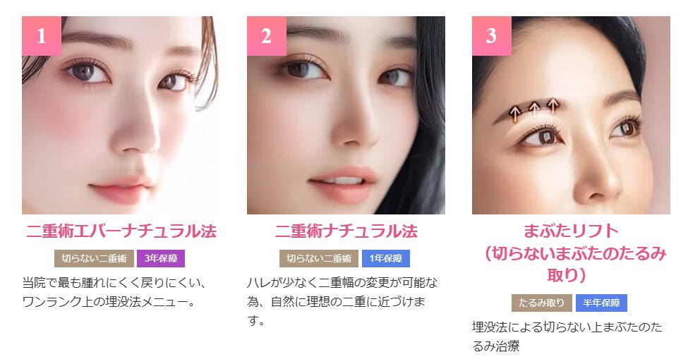 品川美容外科の二重整形FV